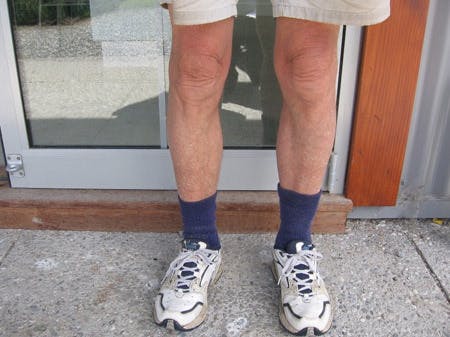 Bobs knees